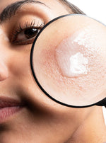 azelaic acid allies of skin texture