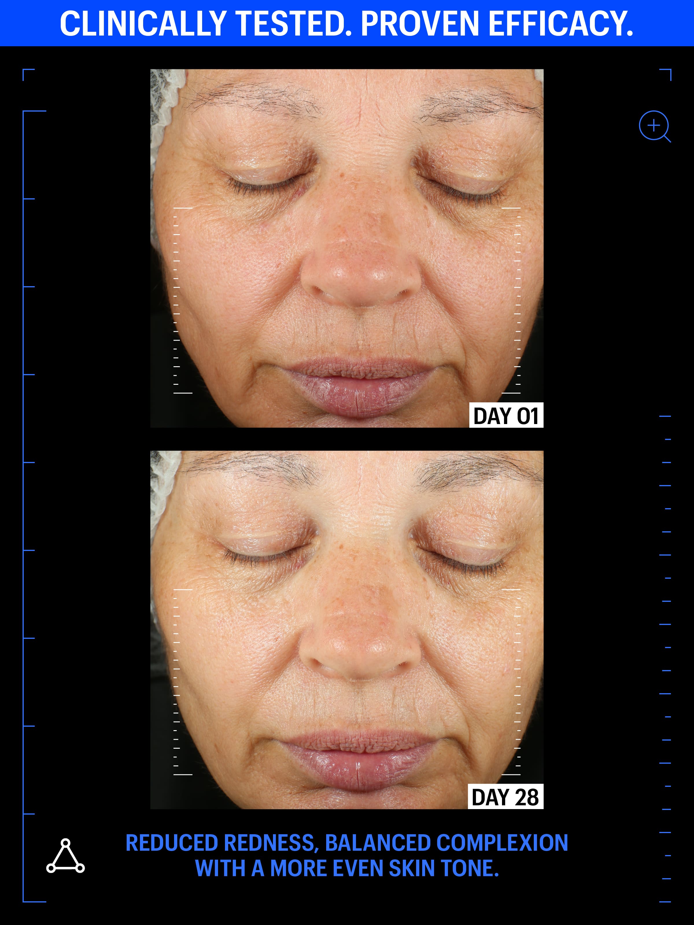 allies of skin redness serum before after