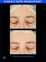 copper peptides serum before after