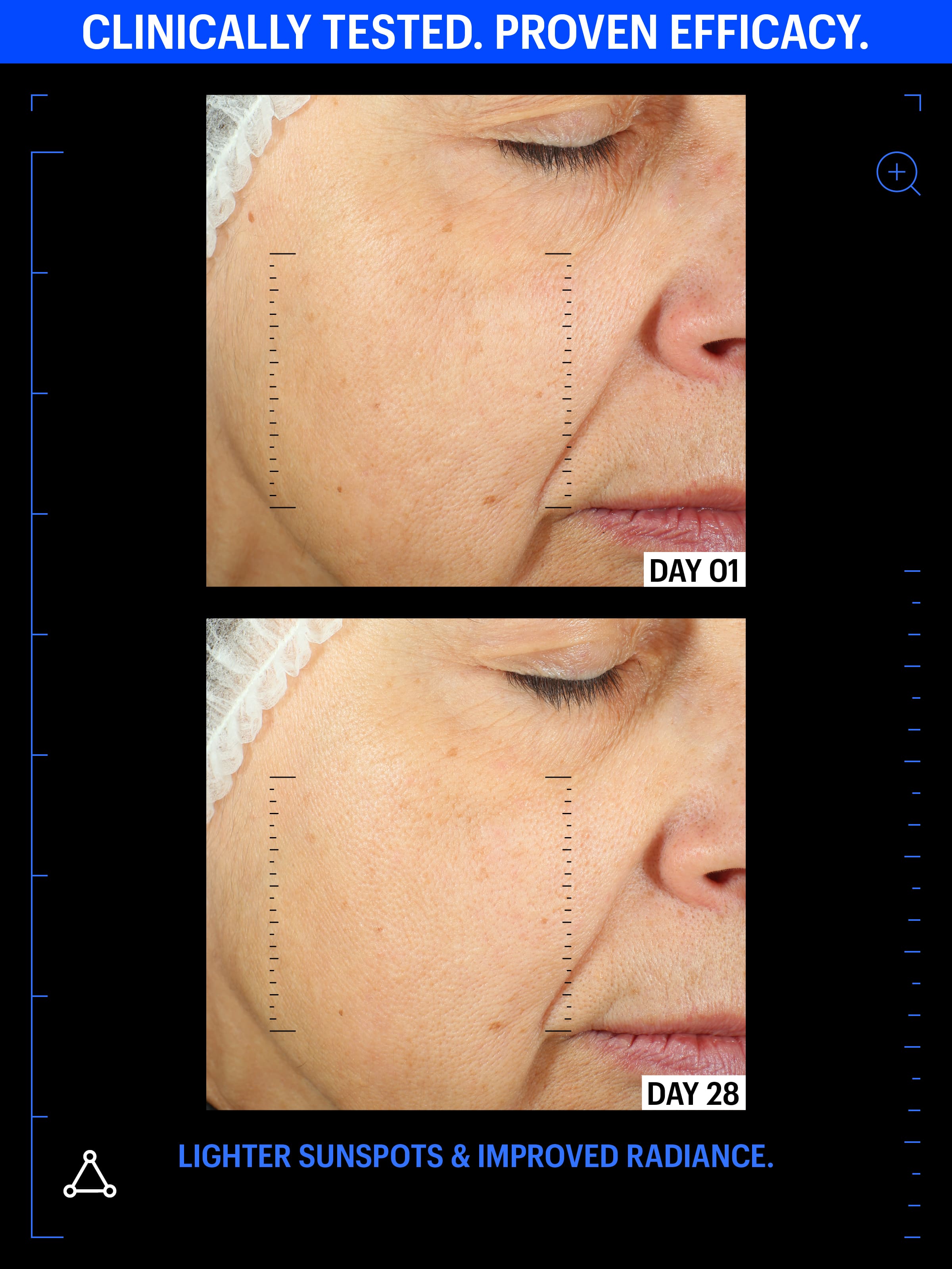 sunspots serum before after