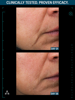 RENEW SKIN + LIPS DUO