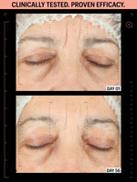 allies of skin peptides before after