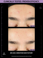 kojic acid and azelaic acid together