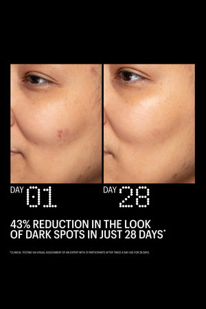 Azelaic & Kojic Advanced Clarifying Serum
