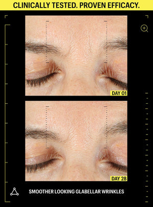 retinol wrinkles before and after