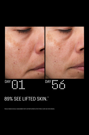 Before and after: 89% saw lifted skin after 56 days of use