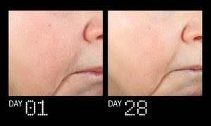 Before-and-after skin comparison showing the lower face and cheek area, labeled DAY 01 and DAY 28, on a black background.