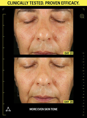 retinol before after