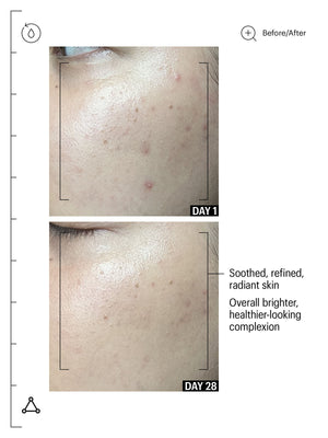 Deluxe 20% Vitamin C Brighten + Firm Serum